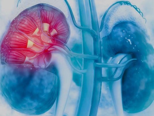 Diabetic Kidney Disease